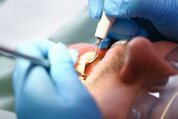 Best Emergency Dental Surgery in Ricardo, TX