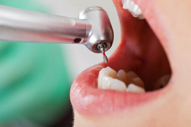 Best Weekend Emergency Dentist in Ricardo, TX
